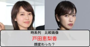 【比較画像】戸田恵梨香は顔変わった？言われる理由も調査