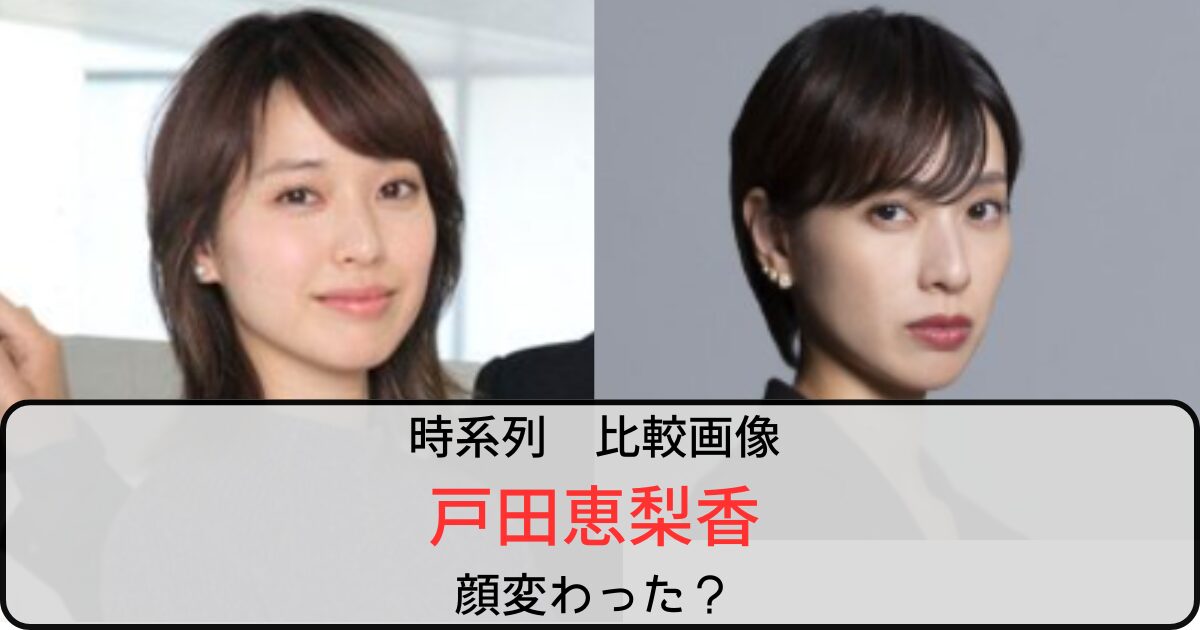【比較画像】戸田恵梨香は顔変わった？言われる理由も調査